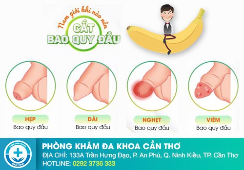 Các dấu hiệu của bệnh dương vật