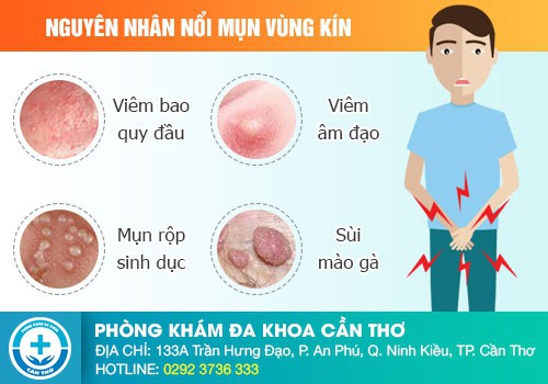 Dương vật nổi mụn ngứa là bệnh gì?