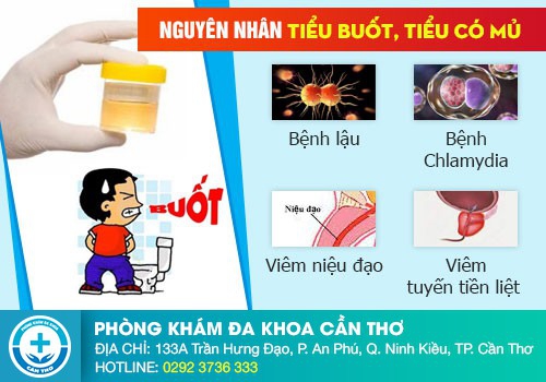 Đi tiểu bị đau cảnh báo bệnh gì?