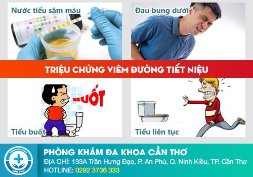 Đi tiểu buốt, tiểu rắt, tiểu nhiều lần là triệu chứng của bệnh gì?