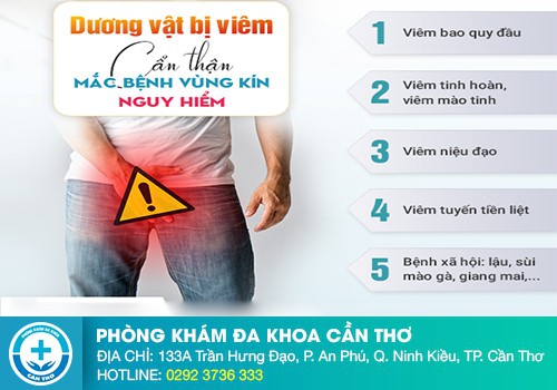 Các dấu hiệu của bệnh dương vật